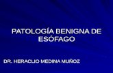 1. Patologia Benigna de Esofago
