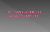 By Pass Gastrico Expo
