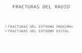 Fracturas Del Radio y Cubito