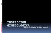 inspeccion ginecologia