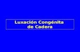 10  luxacion-congenita_de_cadera