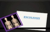 escoliosis exposicion.ppt