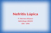 Clase nefritis lupica