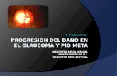 Progresion del dano en el glaucoma y pio