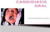 Candidiasis oral