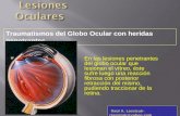 En las lesiones penetrantes del globo ocular que lesionan el vítreo, éste sufre luego una reacción fibrosa con posterior retracción del mismo, pudiendo.