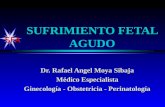SFA SUFRIMIENTO FETAL AGUDO Dr. Rafael Angel Moya Sibaja Médico Especialista Ginecología - Obstetricia - Perinatología.
