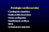 Patología cardiovascular Cardiopatía reumática Endocarditis bacteriana Otras cardiopatias Insuficiencia cardiaca HTA ATEROESCLEROSIS.