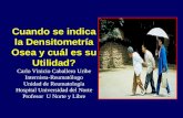 Cuando se indica la Densitometría Osea y cuál es su Utilidad? Carlo Vinicio Caballero Uribe Internista-Reumatólogo Unidad de Reumatología Hospital Universidad.