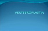 Introducción Según el grupo español de neurorradiología intervencionista (GENI), la vertebroplastia percutánea se define como la inyección de un cemento.