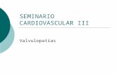 SEMINARIO CARDIOVASCULAR III Valvulopatías. Estenosis Mitral Manifestaciones Clínicas: Disnea: por congestion pulmonar por aumnto de presión en el circuito.