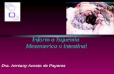 Infarto o Isquemia Mesenterica o intestinal Dra. Anniany Acosta de Payares.