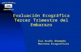 Evaluación Ecográfica Tercer Trimestre del Embarazo Eva Acuña Ahumada Matrona Ecografista.