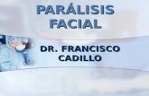 PARÁLISIS FACIAL DR. FRANCISCO CADILLO. DEFINICIÓN DE PARÁLISIS FACIAL Es la pérdida total del movimiento muscular voluntario de un lado de la cara. El.