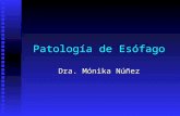 Patología de Esófago Dra. Mónika Núñez. Esófago Normal Función: transportar activamente material ingerido de composición, textura y temperatura variable,