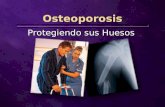 Osteoporosis Protegiendo sus Huesos. Una de cada tres mujeres mayores de 50 años sufre de osteoporosis Una de cada tres mujeres mayores de 50 años sufre.