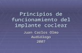 Principios de función del implante coclear