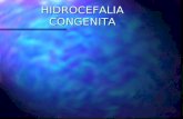 HIDROCEFALIA CONGENITA. DEFINICION Hydros= agua Hydros= agua Cephalus= cabeza Cephalus= cabeza Hidrocefalia congénita: Crecimiento progresivo ventricular.