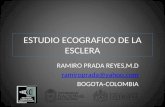 ESTUDIO ECOGRAFICO DE LA ESCLERA RAMIRO PRADA REYES,M.D ramiroprada@yahoo.com BOGOTA-COLOMBIA.