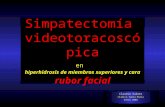 Simpatectomía videotoracoscópica en hiperhidrosis de miembros superiores y cara rubor facial Claudio Suárez Clínica Santa María Enero 2008.