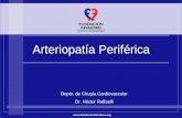 Www.fundacionfavaloro.org Arteriopatía Periférica Depto. de Cirugía Cardiovascular Dr. Héctor Raffaelli.