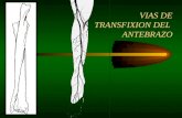 VIAS DE TRANSFIXION DEL ANTEBRAZO. V. Cefálica y Cefálica accesoria V. Radial. A. V. N. Mediano A. V. Interóseas caudales A. V. Interóseas craneales.
