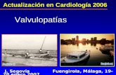 Actualización en Cardiología 2006 Valvulopatías J. Segovia Fuengirola, Málaga, 19-20 enero 2007.