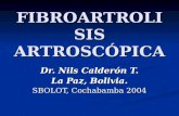 FIBROARTROLISIS ARTROSCÓPICA Dr. Nils Calderón T. La Paz, Bolivia. SBOLOT, Cochabamba 2004.