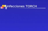 Infecciones TORCH. ¿Qué significa TORCH? TO Toxoplasmosis R Rubéola C Citomegalovirus H Herpes virus.