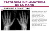 PATOLOGÍA INFLAMATORIA DE LA MANO ARTRITIS REUMATOIDE : Importante afectación de las articulaciones radio-cubital distal, radiocarpiana, intercarpiana.