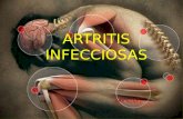 ARTRITIS INFECCIOSAS DRA NUNEZ. El Staphylococcus aureus, Neisseria gonorrhoeae y otras bacterias son los agentes que más a menudo producen artritis infecciosas,
