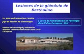 Lesiones de la glándula de Bartholino Dr. Juan Pedro Martínez Cendán Jefe de Sección de Ginecología Servicio de Ginecología y Obstetricia Hospital General.