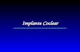 Implante Coclear....................................