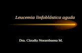 Leucemia linfoblástica aguda Dra. Claudia Norambuena M.