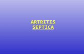 Artritis - Osteomielitis