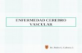 ENFERMEDAD CEREBRO VASCULAR Dr. Pedro G. Cabrera J.