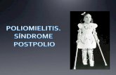 Poliomielitis. Síndrome postpolio