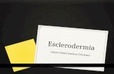 Esclerodermia (esclerosis sistemica)