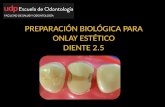 Preparacion onlay estetico diente 2.5