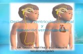 Derivación ventriculoperitoneal y ventriculoatrial