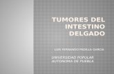 Tumores Benignos y Malignos del intestino Delgado
