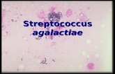 Streptococcus Agalactiae