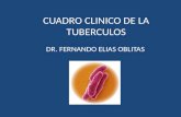 Cuadro clinico de la tuberculos