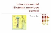 Tema 14. infecciones del sistema nervioso central