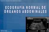 Ecografia organos abdominales Curso Eco DSGM 2014