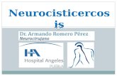 Neurocisticercosis ARP