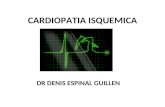 2. cardiopatia isquemica