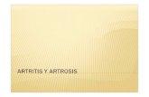 Artritis y artrosis por mercedes carandini