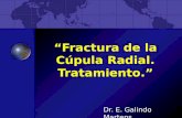 Fractura cupula radial.
