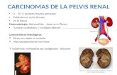 Carcinoma pelvis renal